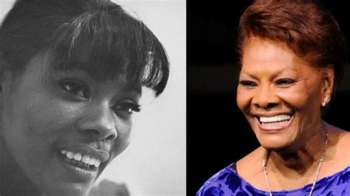 A Look At Dionne Warwick’s Teeth Before And After Pictures