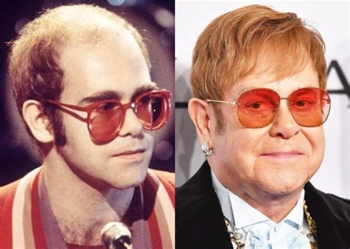 Does Elton John Wear A Wig?